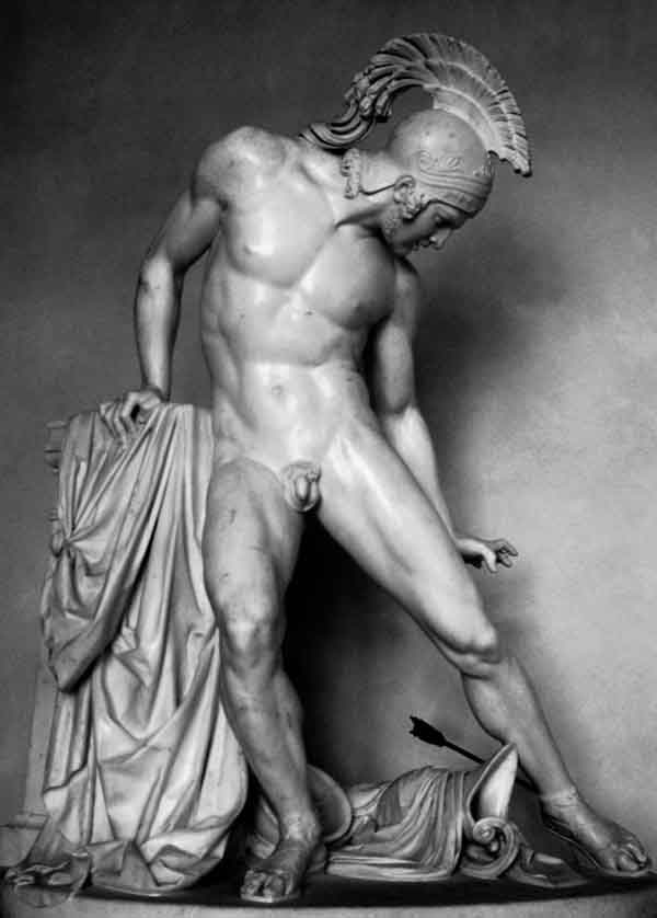 阿奇里斯（Achilles），就像致命箭頭擊中他的腳跟一樣，是偉大英雄唯一的弱點。伊諾森佐·弗拉卡羅利（Innocenzo Fraccaroli）的雕塑，1842年。